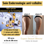 Le soin Endermologie anti-cellulite et ses cosmétiques